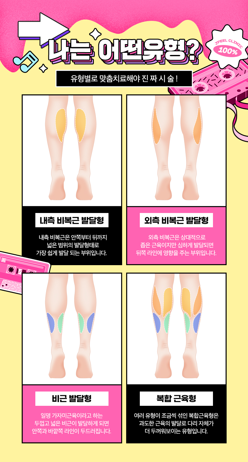 종아리근육제거 어떻게 해야할까? 제이필 부츠쏙주사로 매끈하게 관련 이미지 3