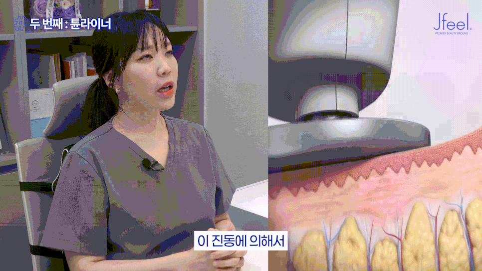 다이어트 후에도 안 빠지는 군살? 지방분해주사·바디온다로 알아보는 바디라인 관리 관련 이미지 15