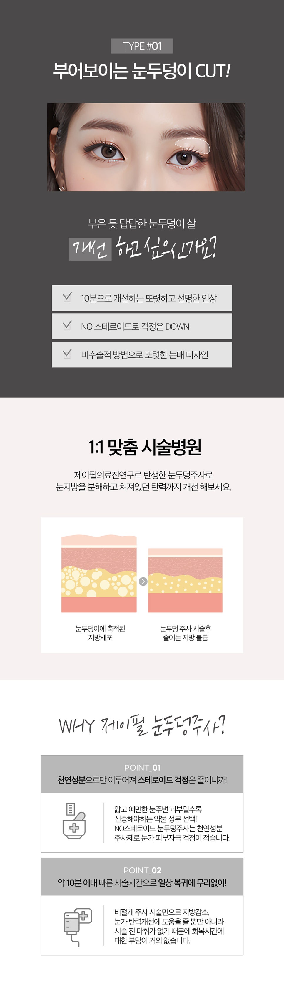 얼굴살정리가 필요하다면 지방컷 관련 이미지 3