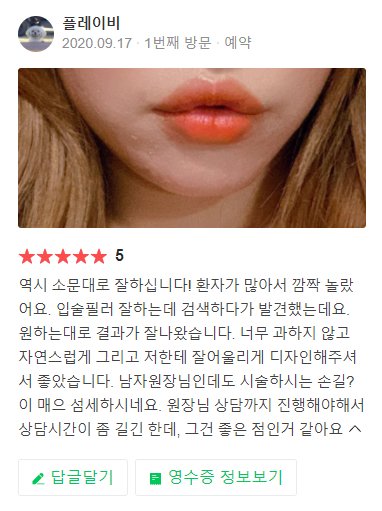 입술필러 유지기간 얼마나 되나요? 관련 이미지 8
