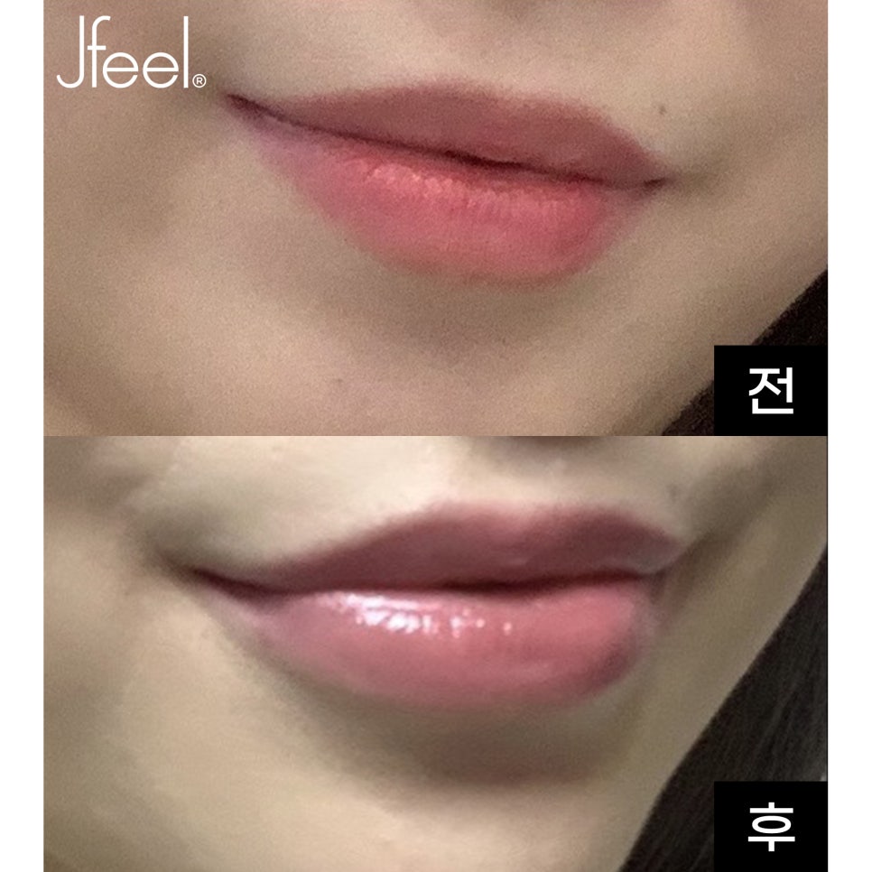 자연스러운 입술필러 후기/전후/가격 알아보세요 관련 이미지 2