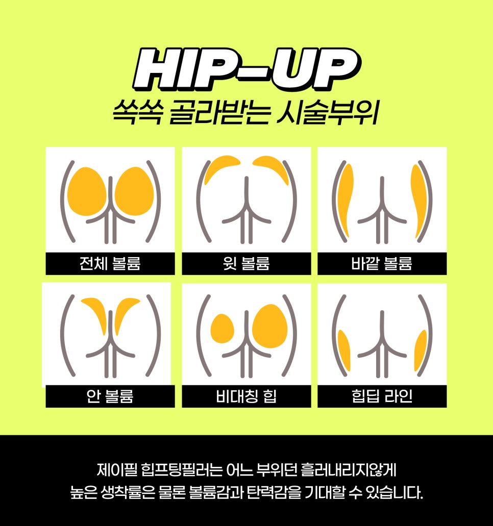 볼륨빵빵 애플HIP만드는 HIP프팅, 엉덩이필러 관련 이미지 2