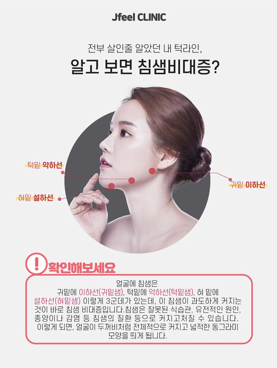 보톡스를 이용한 안면 주름개선과 발달된 근육 축소 시술 관련 이미지 6