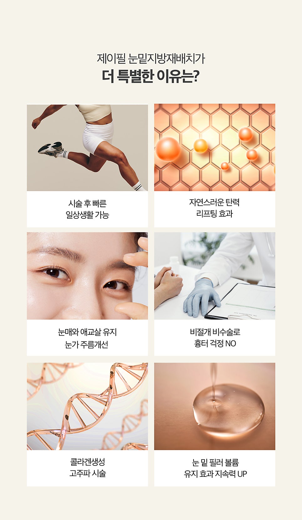눈밑지방제거방법을 찾는다면? 비수술 비절개로! 관련 이미지 4
