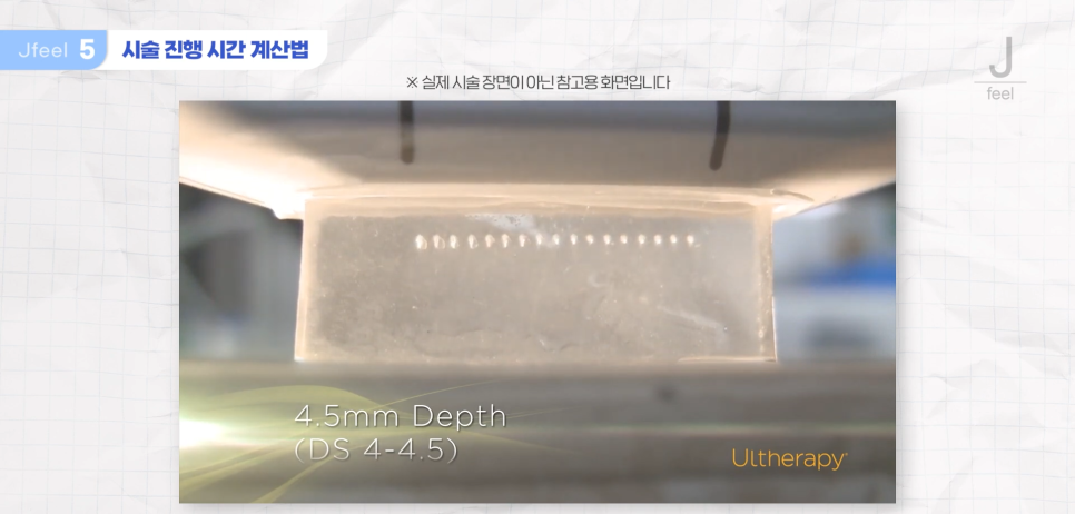 울쎄라샷수, 가성비 있게 예산 짜는 방법 대공개 관련 이미지 5