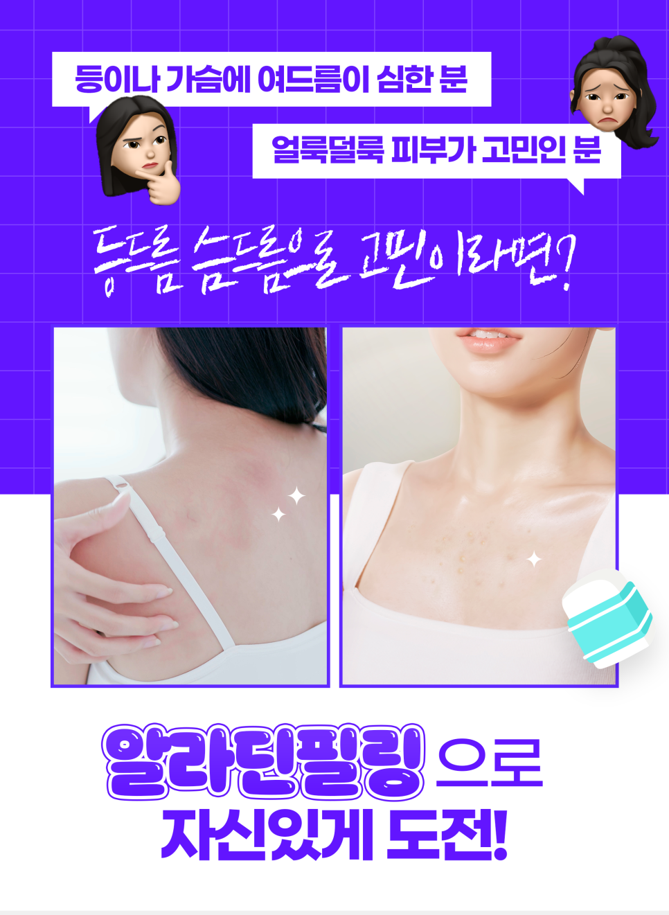 등드름가드름, 여름 되기 전에 없애자 관련 이미지 3