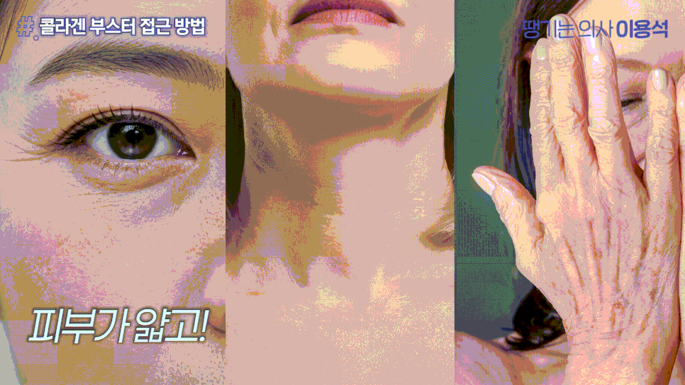 30대 40대 피부관리 추천|고우리·써마지·줄기세포 시술 TOP3 관련 이미지 3