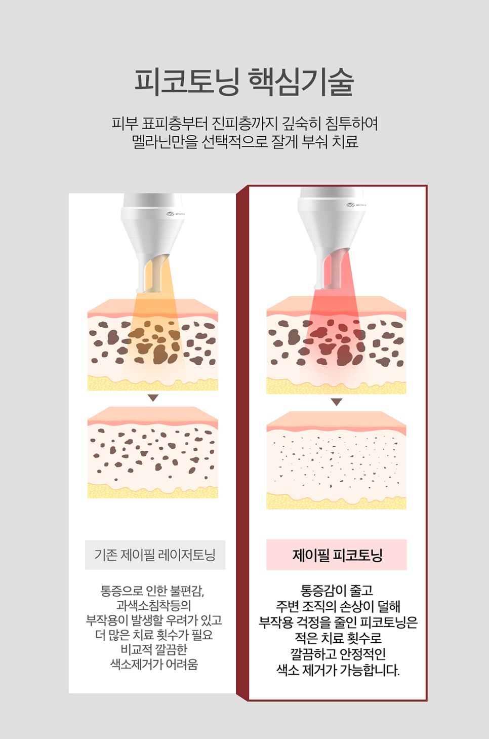 레이저토닝잘하는곳에서 추천하는 피코토닝 관련 이미지 4