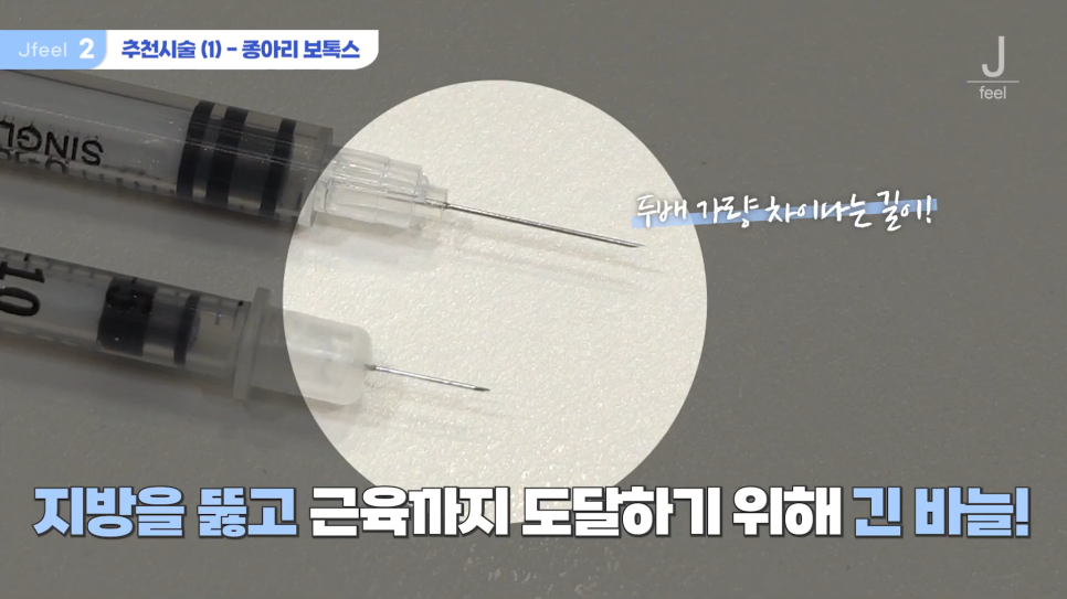 '팬츠리스룩'을 위한 셀룰라이트제거 시술 관련 이미지 6