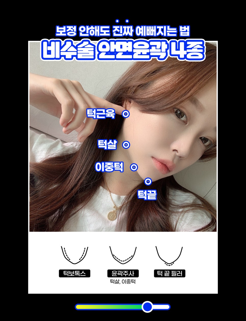 비수술 안면윤곽 4종세트로 작고 갸름한 얼굴만들기! 관련 이미지 2