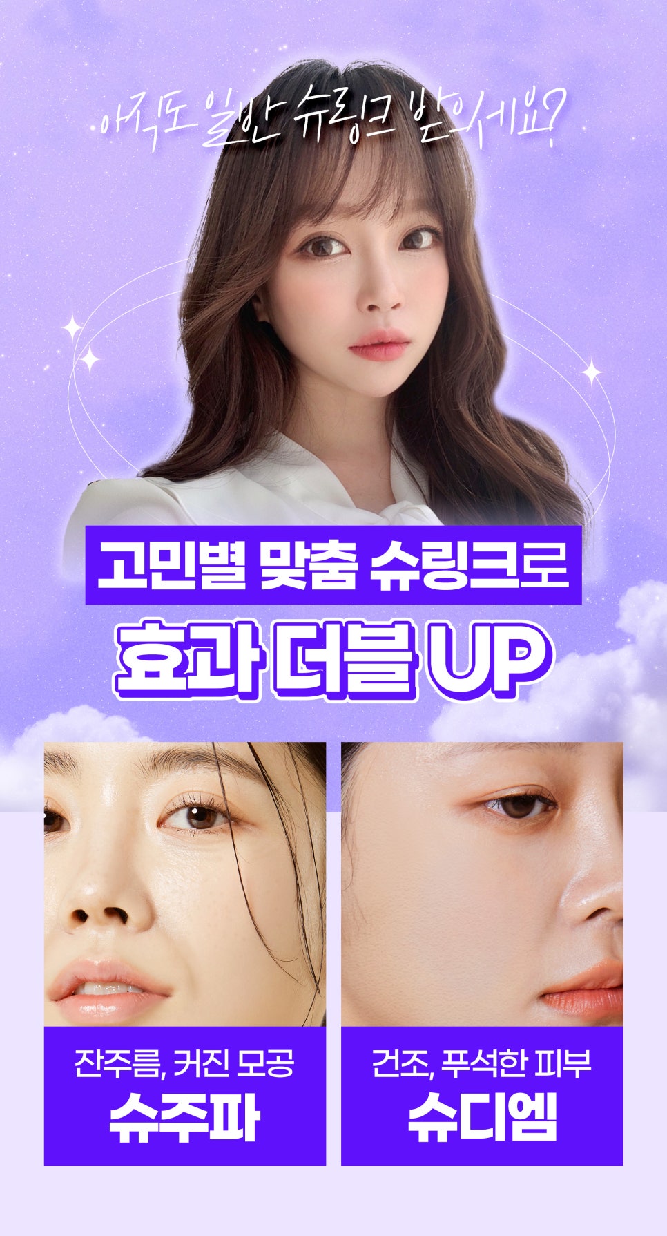 심부볼지방제거 리프팅, 슈주파 슈디엠으로 해결 관련 이미지 2