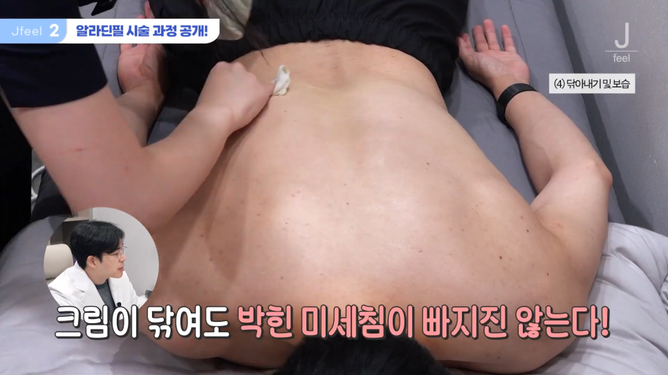 등여드름필링으로 연예인 등 만들기 관련 이미지 10