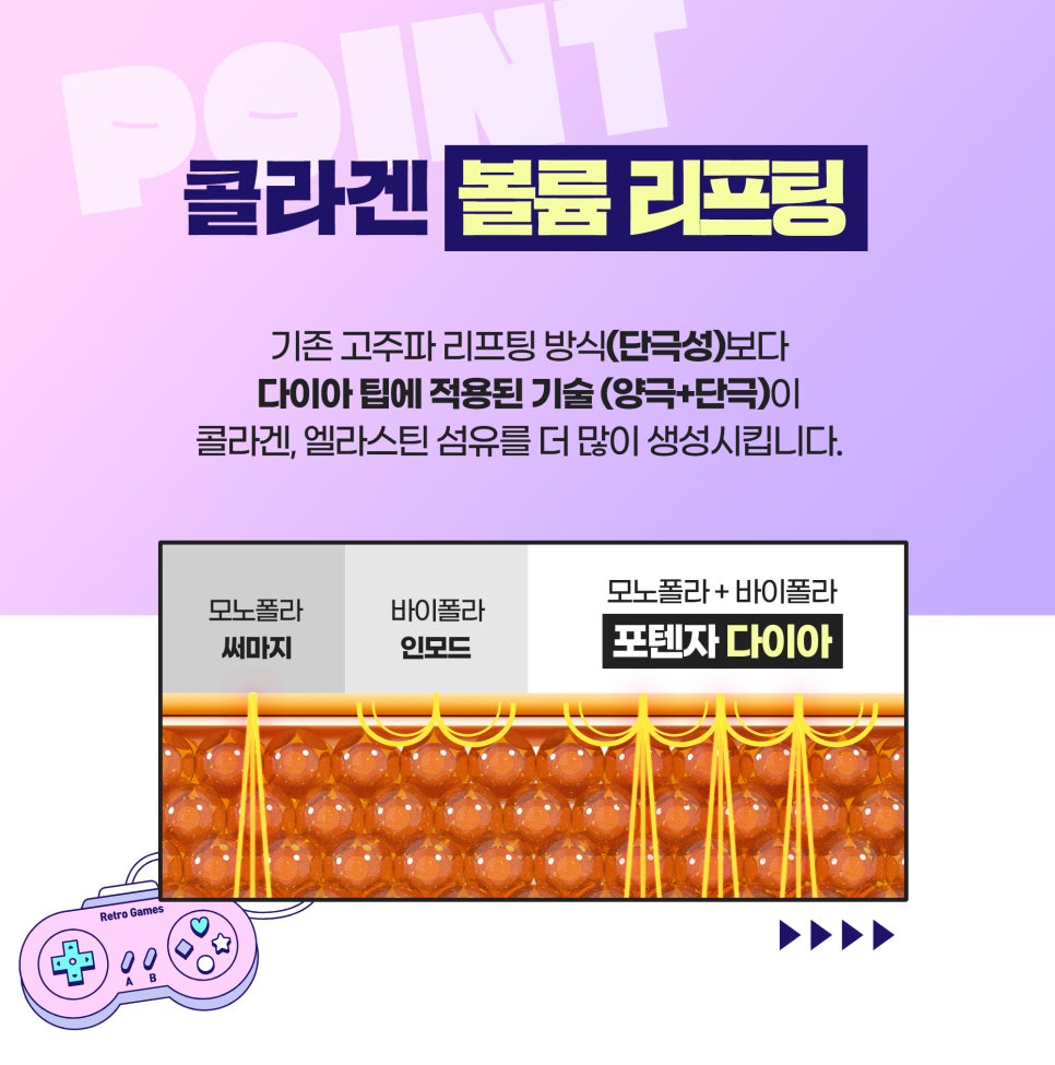 포텐자다이아, 리프팅으로 피부 탄력 되찾기! 관련 이미지 5