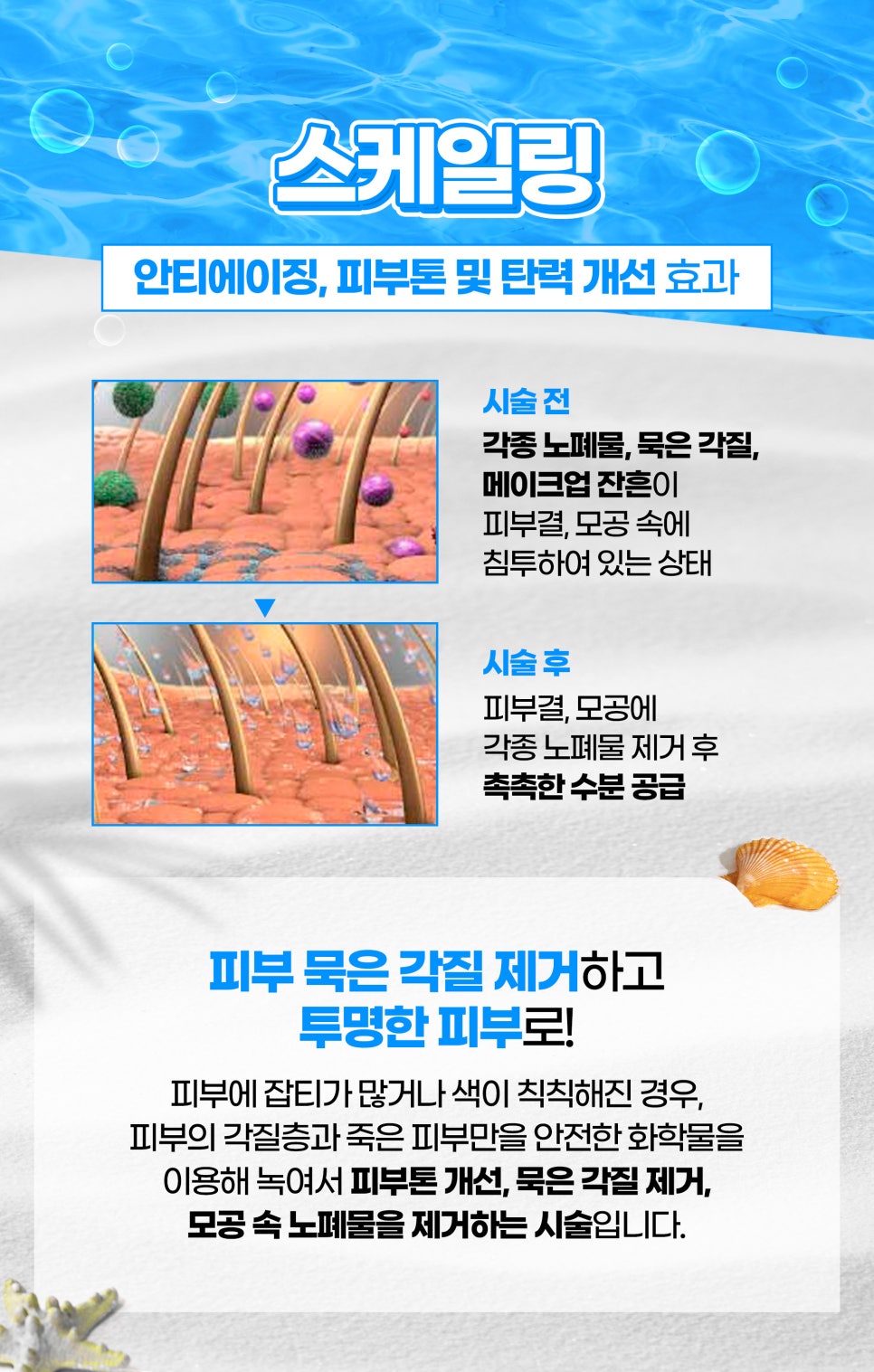 피부토닝과 쿨링관리를 동시에! 제이필 ICE쿨링토닝으로 관련 이미지 4