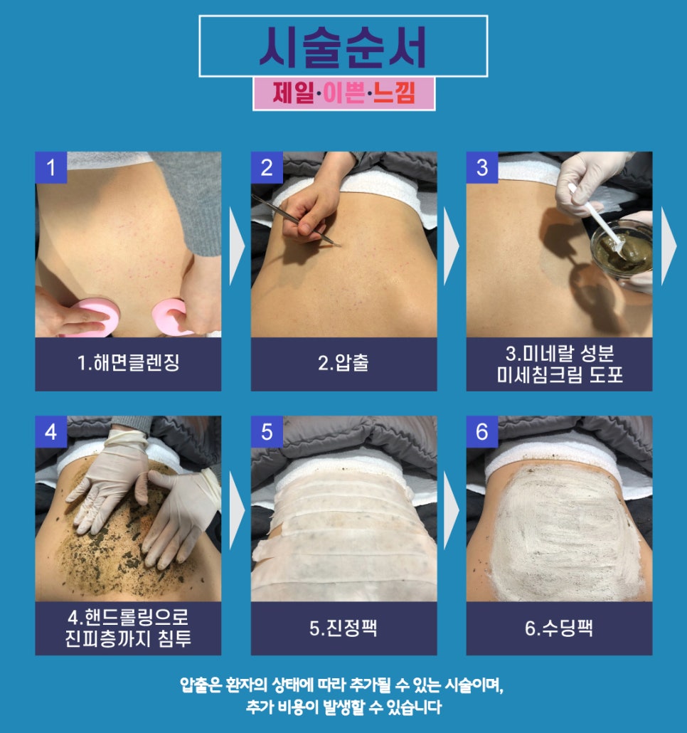 여드름과 흉터 개선에 도움을 주는 치료 방법 관련 이미지 13