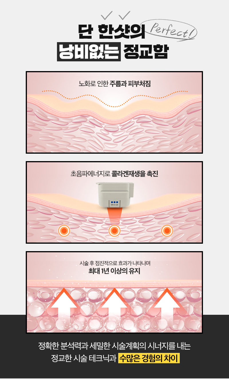 탄력리프팅, 제이필의 풀페이스울쎄라로 속부터 탄력감 있게! 관련 이미지 4