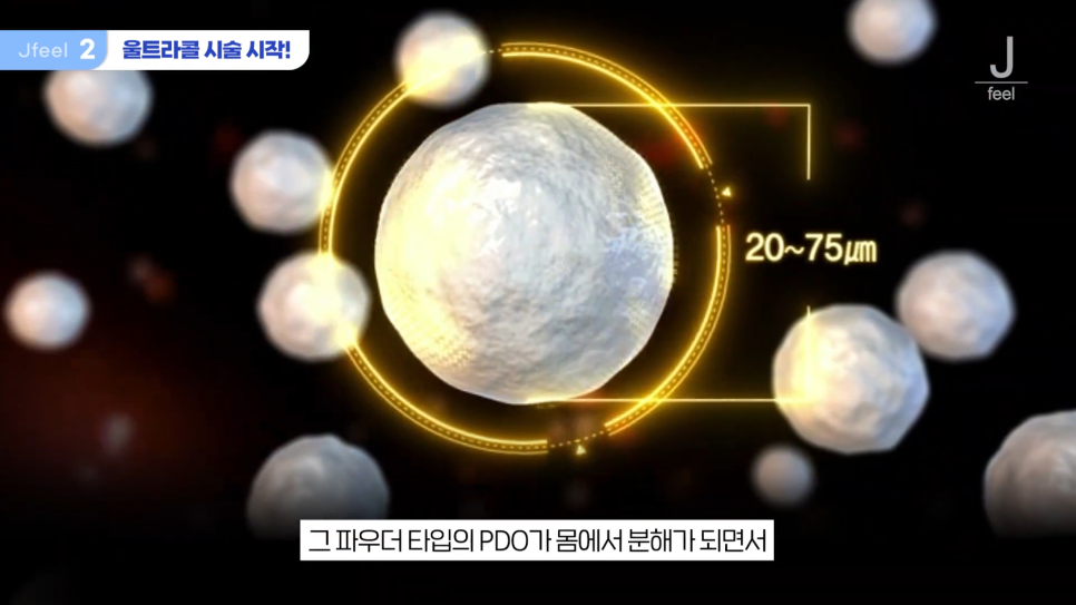필러가 싫다면? 눈가, 팔자, 주름 해결하는 울트라콜 관련 이미지 7