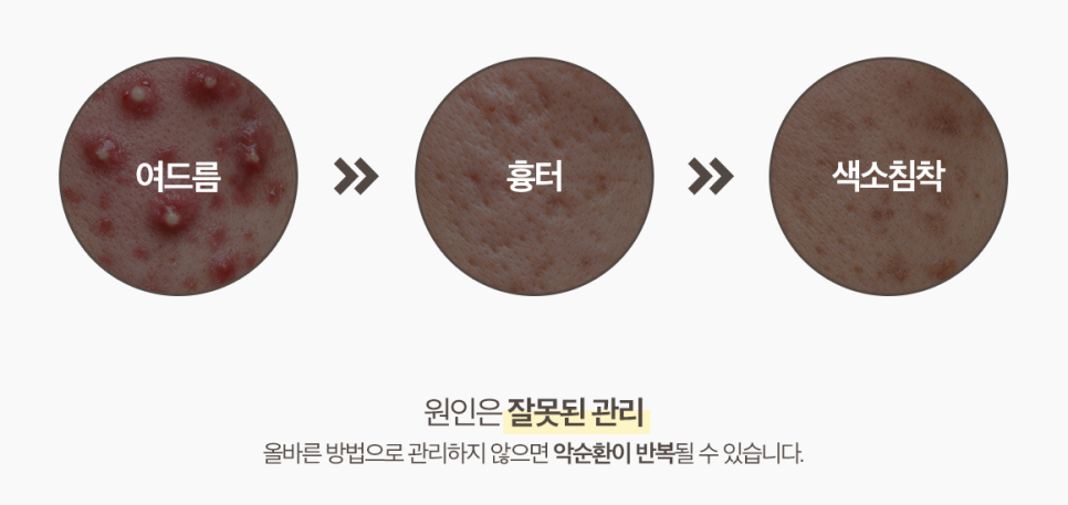 Summer Sebum · Pore · Lifting Care Guide|Jfeel Clinic July Programs image 9