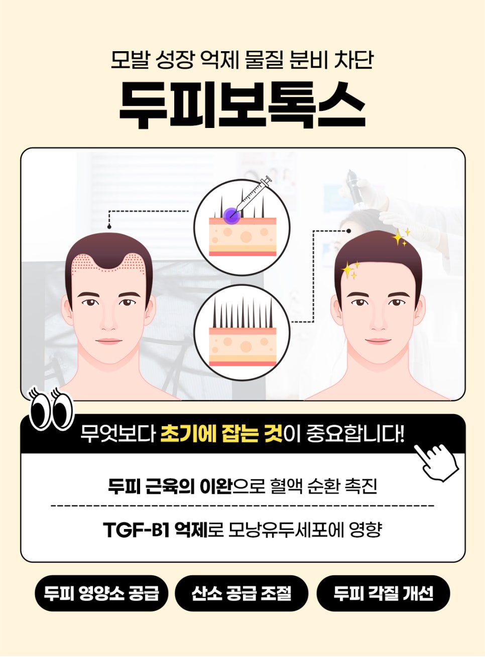 탈모치료피부과를 찾는다면? 홍대 제이필의원 관련 이미지 4