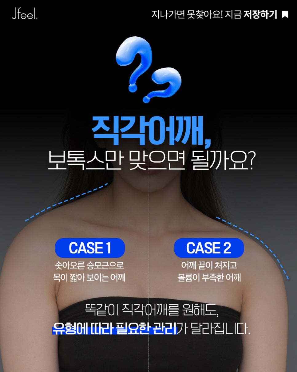 직각어깨 만드는 법, 승모근 보톡스 맞아도 안 되는 이유 관련 이미지 2