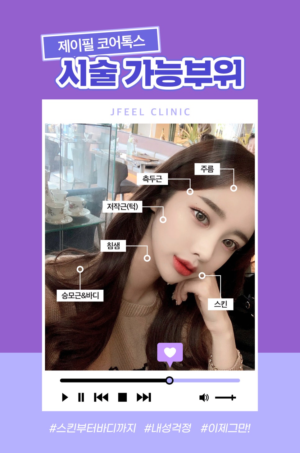 보톡스 내성 걱정된다면? 부담 적은 코어톡스로 관련 이미지 5