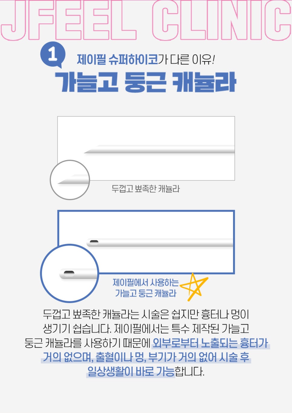 슈퍼하이코 만족도 높은 코 필러 알아본다면 제이필클리닉 관련 이미지 4