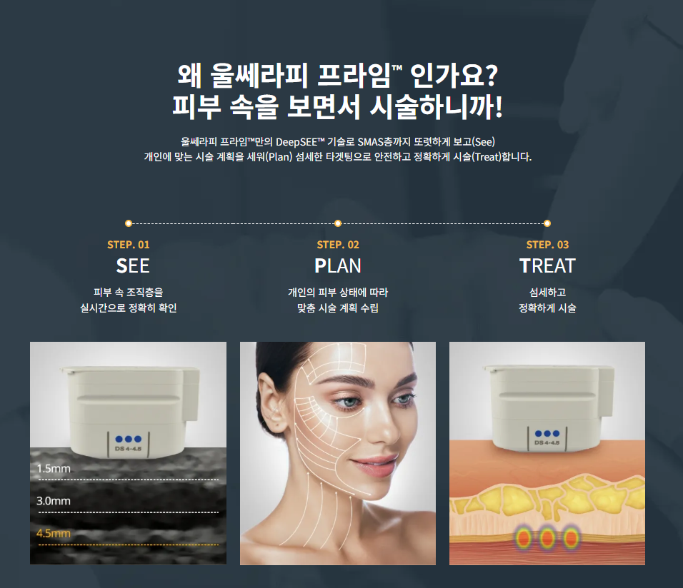 얼굴살 없으면 울쎄라 하면 안 될까? 볼패임 걱정된다면 확인할 것 관련 이미지 11