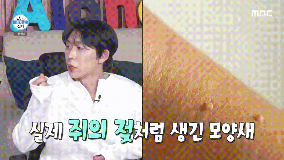 나혼산 박나래 쥐젖제거 홍대 쥐젖 피부과 얼굴 목 쥐젖 제거 비용 관련 이미지 7