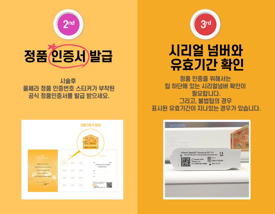 인모드,울쎄라를 이용한 리프팅 시술시 효과와 주의사항 관련 이미지 16
