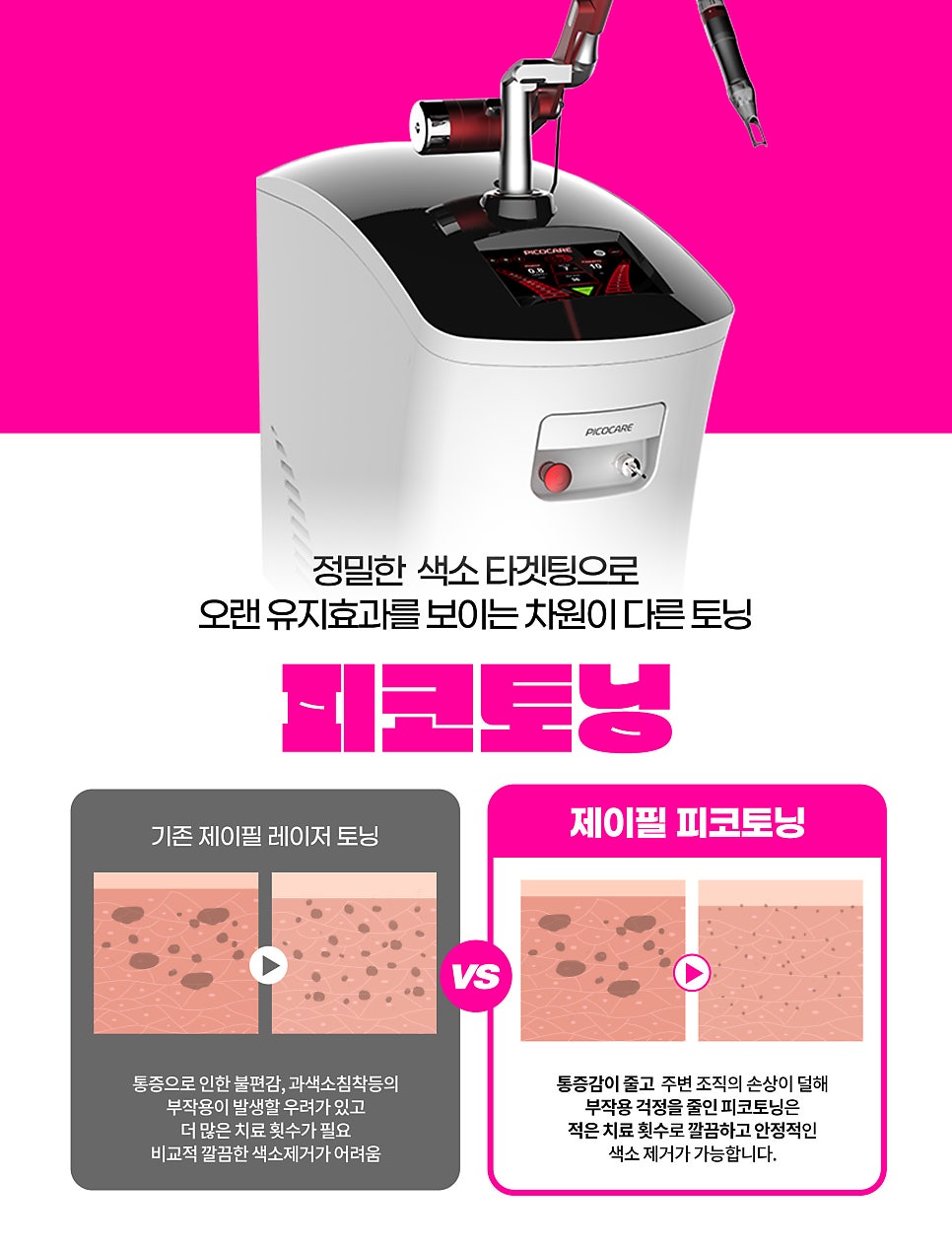 기미, 잡티, 주근깨 다양한 색소치료는 피코토닝패키지 피코에볼루션으로 관련 이미지 3
