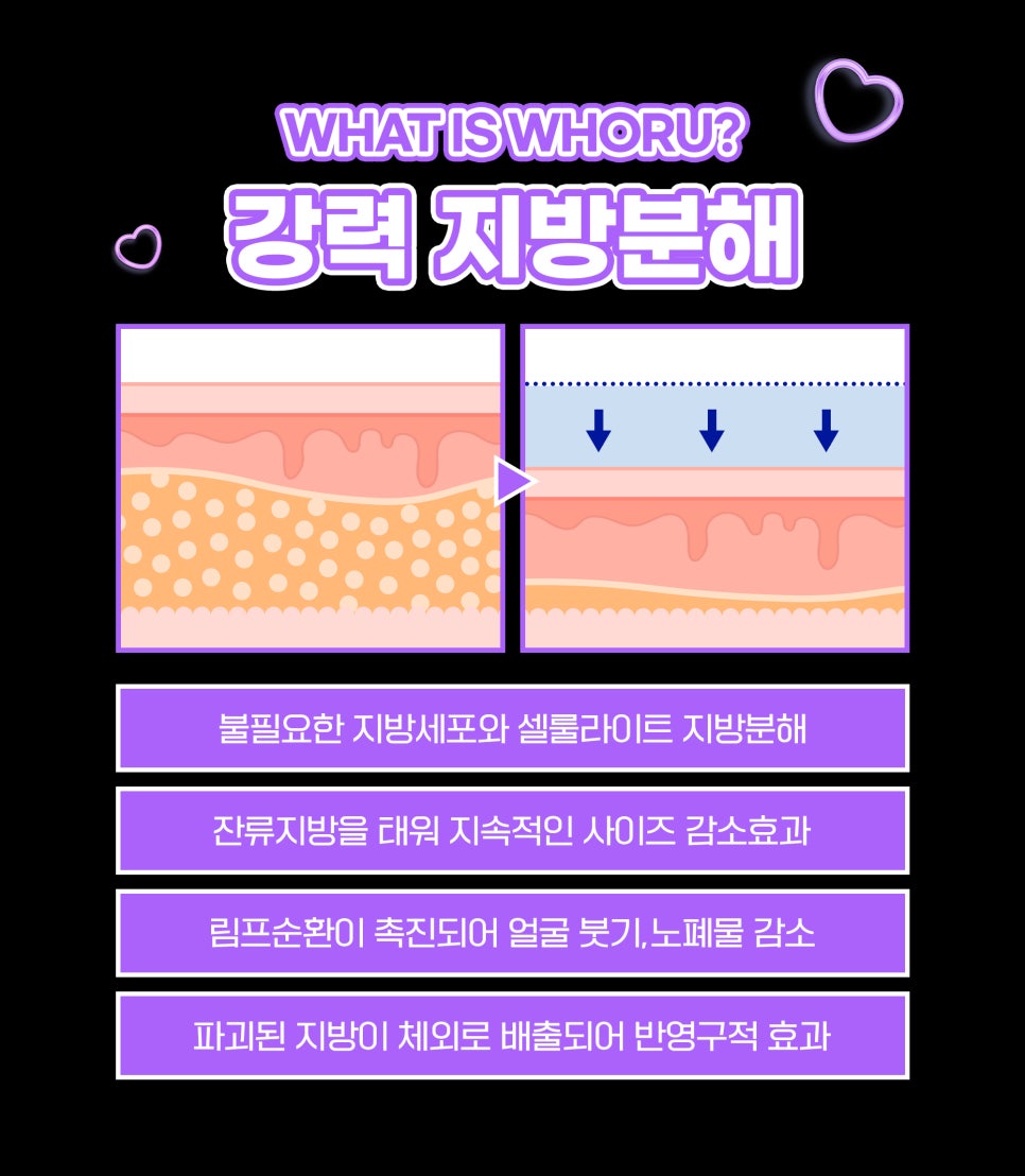 갸름한얼굴, 어플주사로 확실하게 만들기 관련 이미지 4
