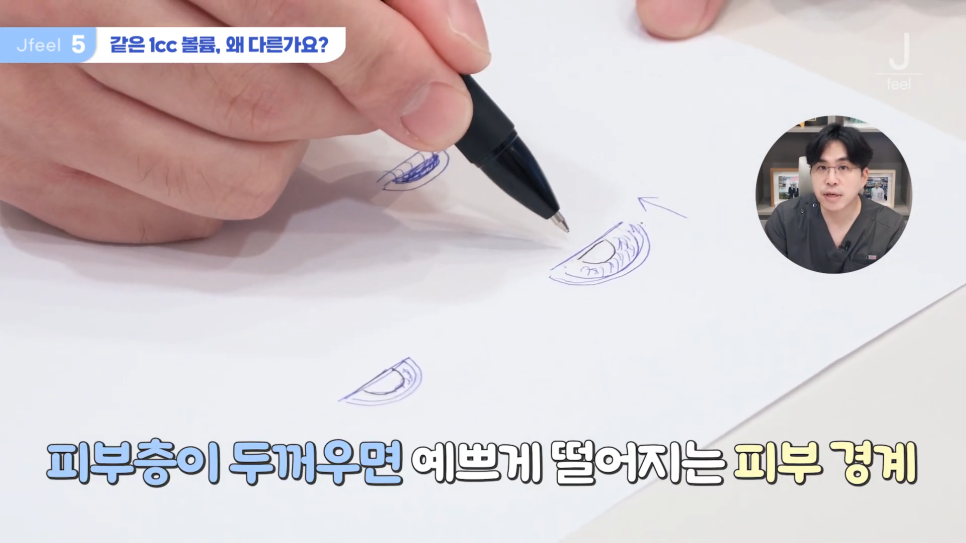 필러시술, 좋은 필러를 고르는 3가지 기준 관련 이미지 17