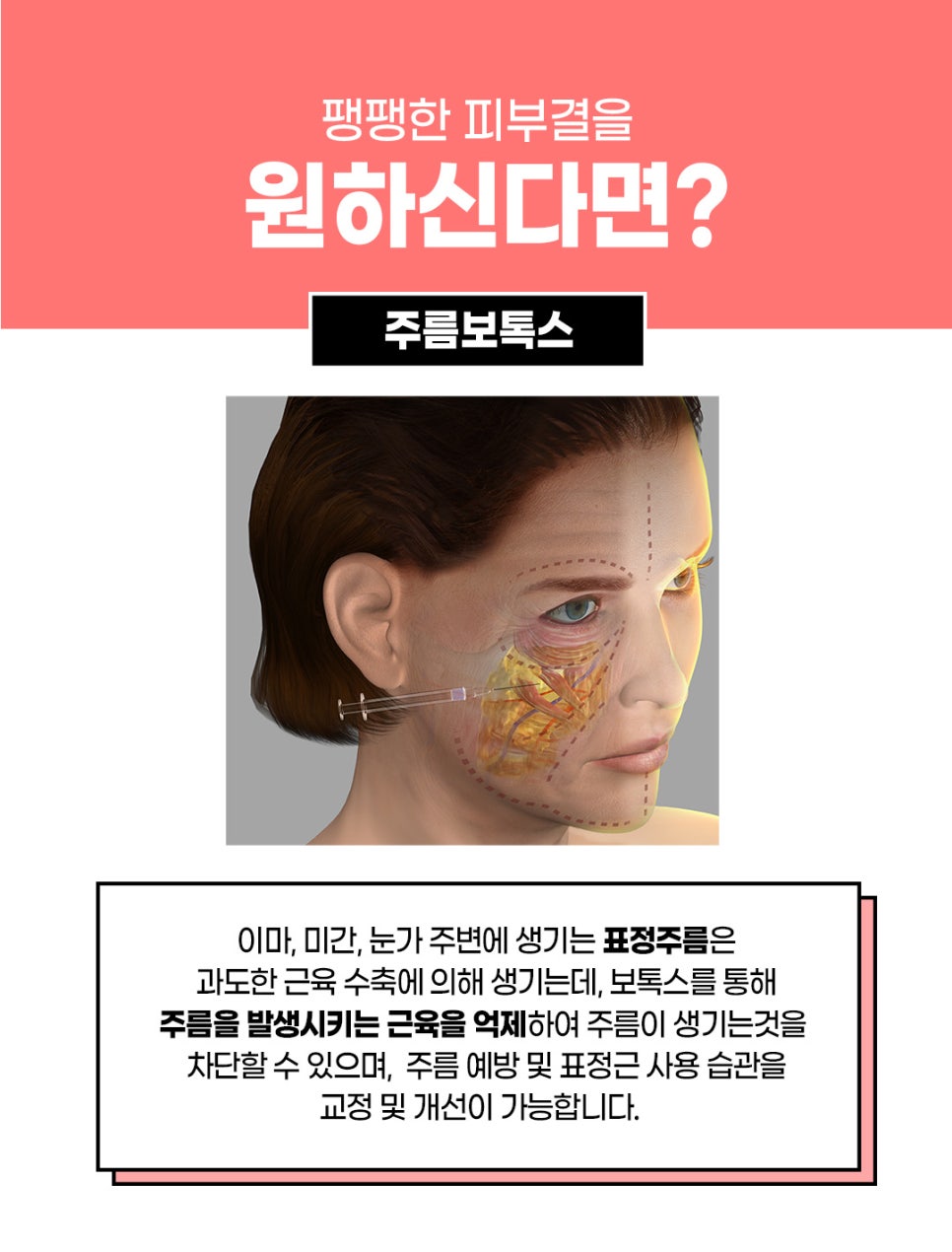 턱주름보톡스, 주름은 팽팽하게 턱은 갸름하게 관련 이미지 4