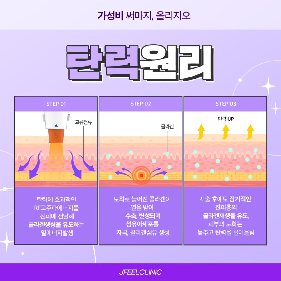 올리지오와 슈링크를 이용한 주름과 피부탄력 개선 관련 이미지 4