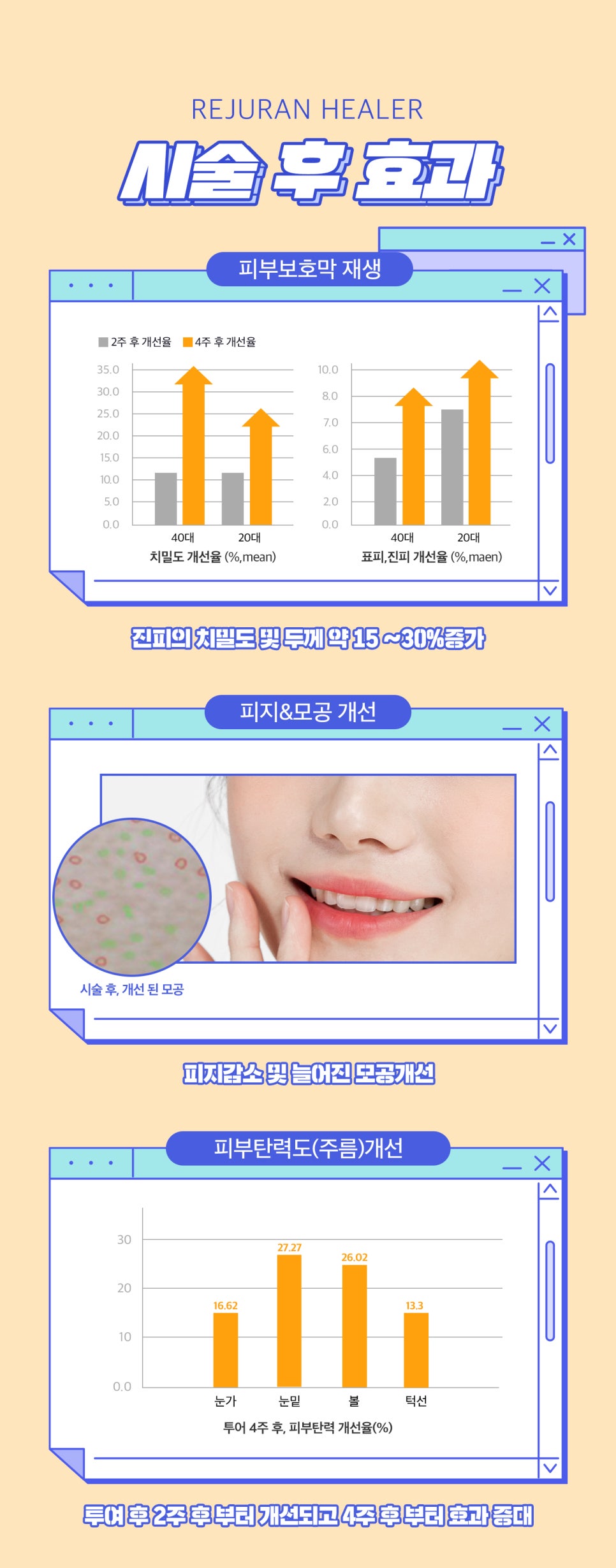 리쥬란힐러 효과, 시기 스킨부스터의 능력알아보기 관련 이미지 3