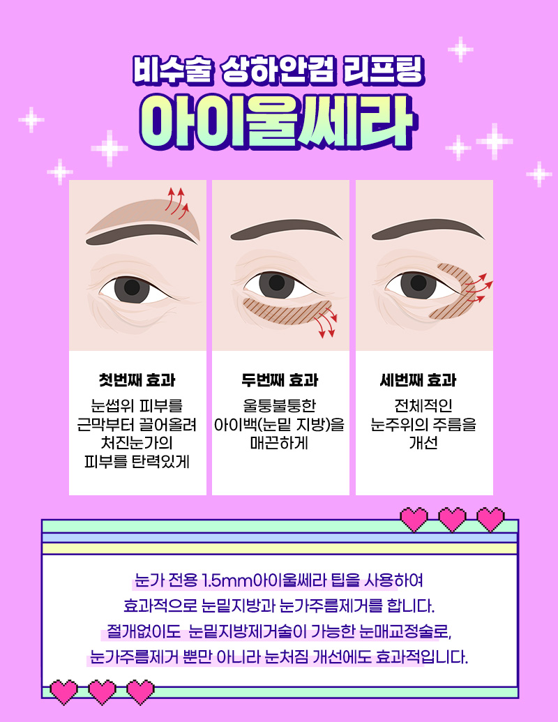 눈가주름제거, 잔주름, 퀭한 눈, 처진 눈 맞춤 케어 관련 이미지 4