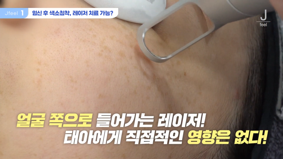 임산부피부과 시술 가능한가요? Q&A 관련 이미지 3