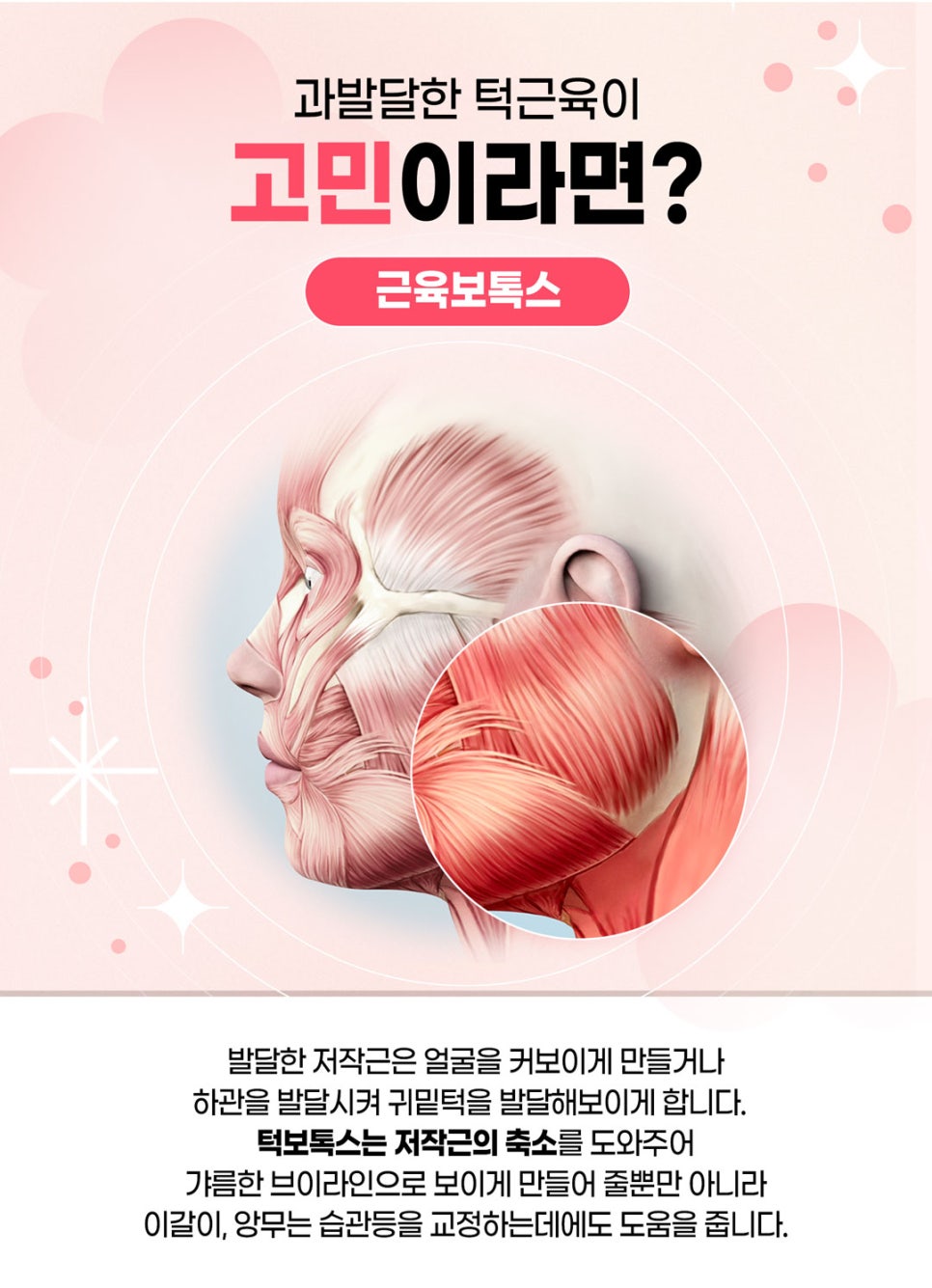 사각턱 주름보톡스로 갸름하고 팽팽하게! 관련 이미지 3