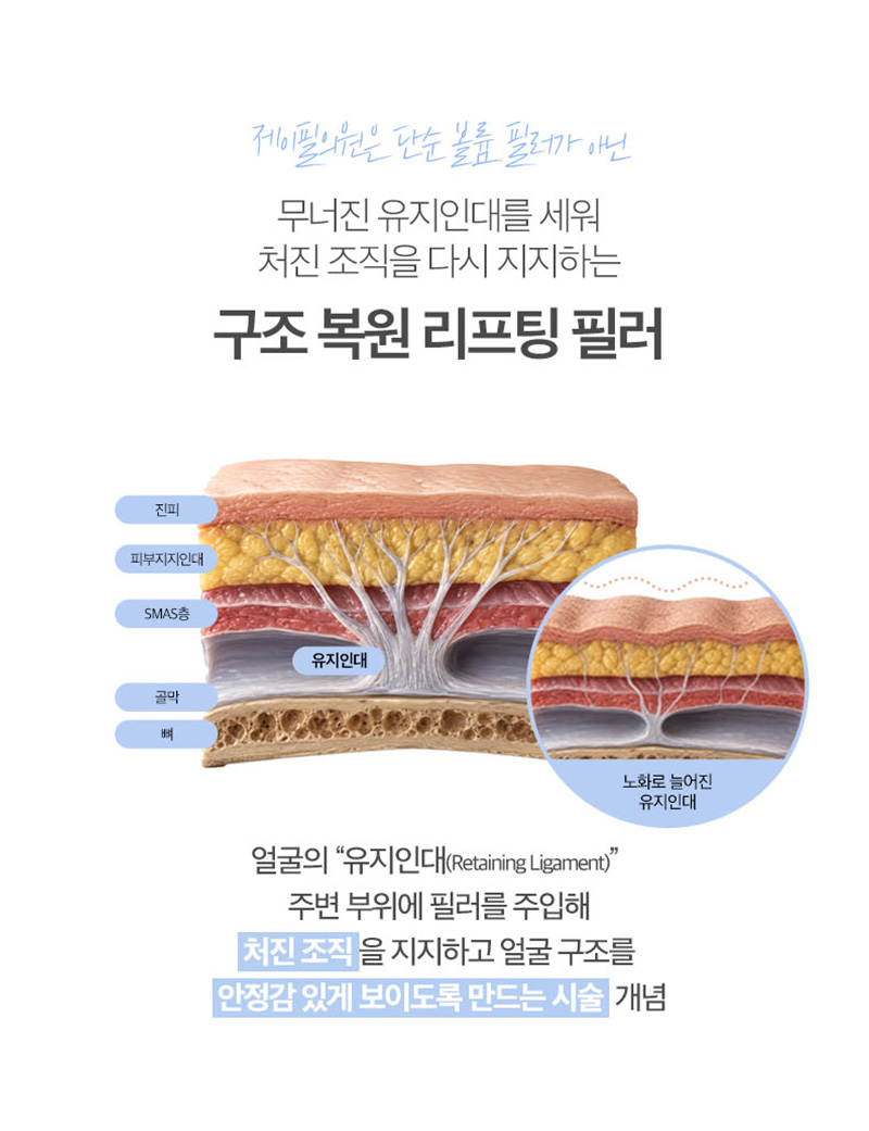 Ligament Filler + ONDA | Why Mid-Cheek and Jawline Lifting Matter image 22