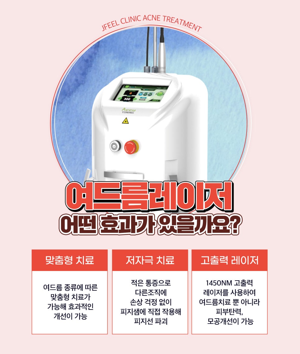 피지분비, 피지억제레이저로 여드름 끝장내기! 관련 이미지 4