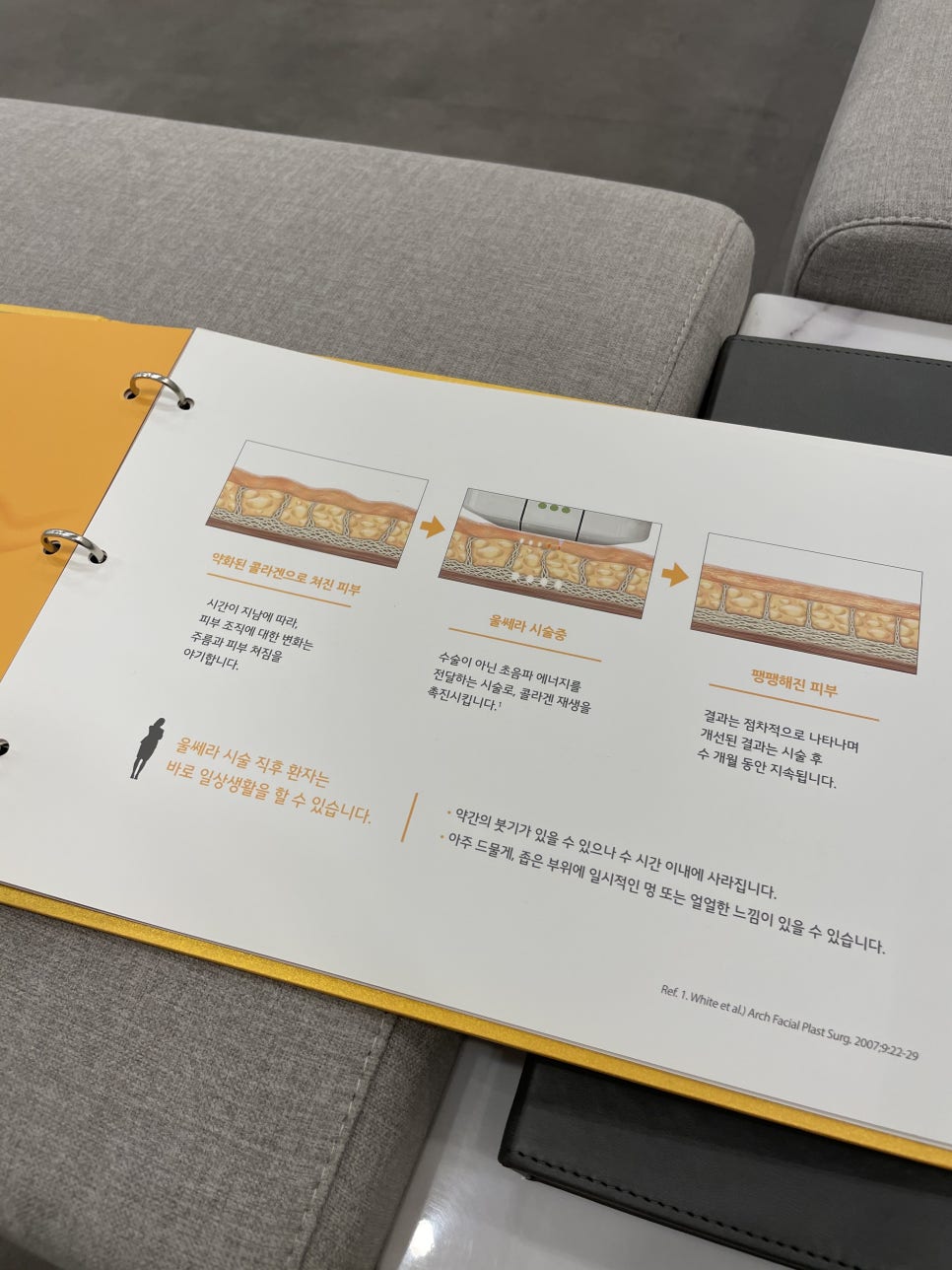 울쎄라리프팅은 목주름, 팔자, 눈가주름에도 효과적입니다. 관련 이미지 3