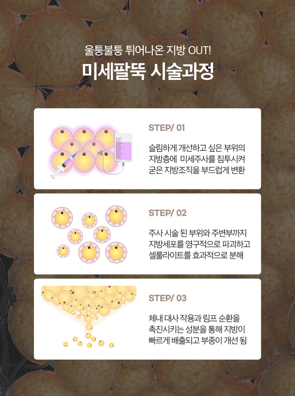 날씬한팔뚝만들기는 미세팔뚝주사 관련 이미지 4