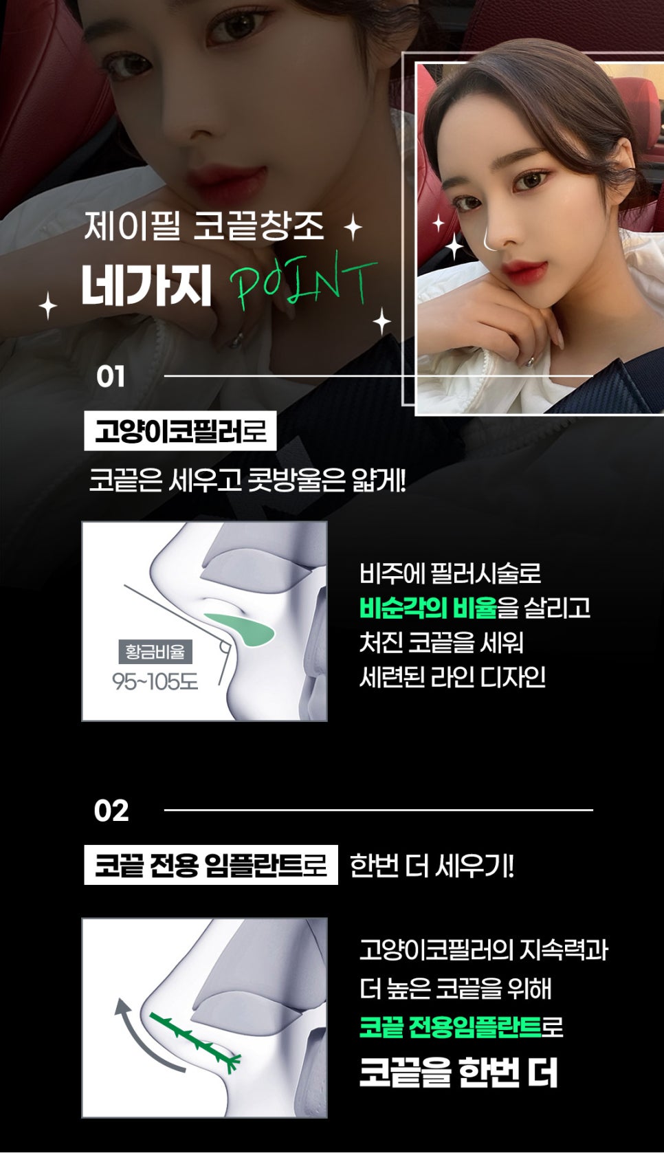 코끝시술, 제이필 코끝창조로 더 높게! 관련 이미지 6