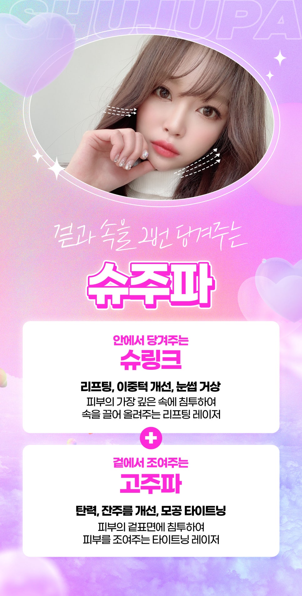 심부볼지방제거 리프팅, 슈주파 슈디엠으로 해결 관련 이미지 3