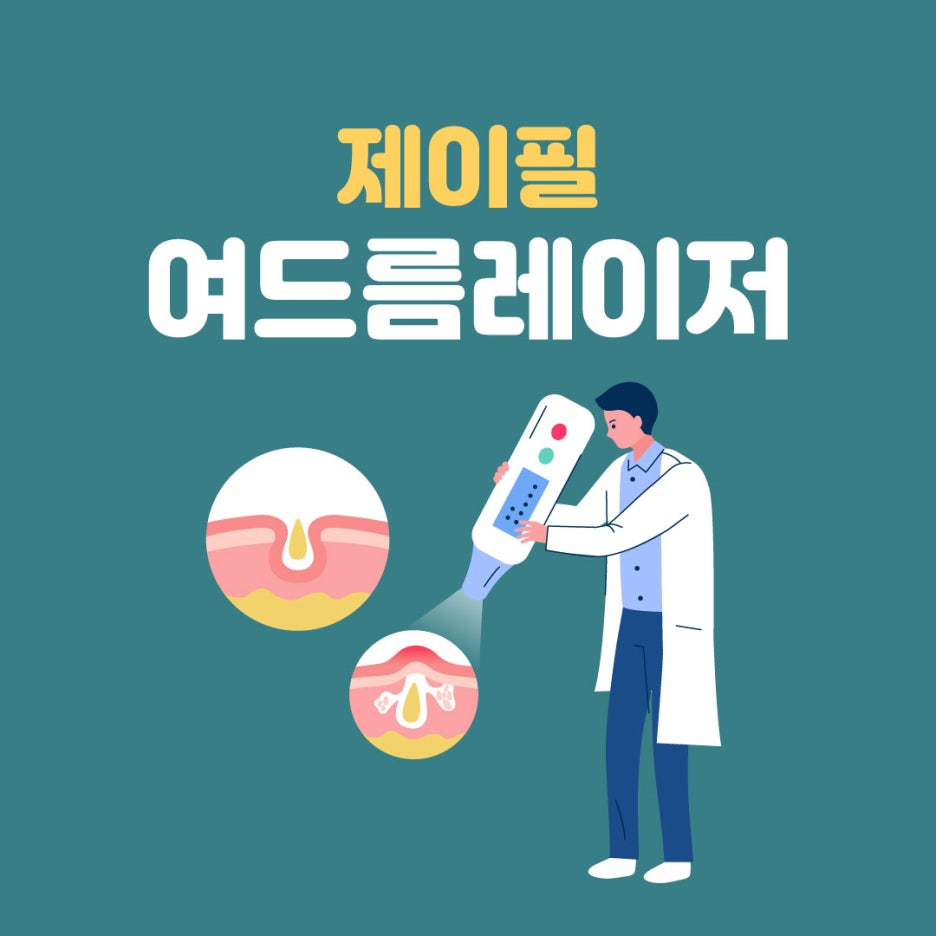 신촌피부과 여드름 레이저로 압출없이 깨끗한 피부 가지세요 관련 이미지 1