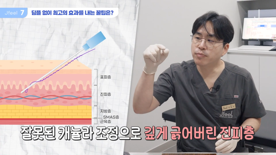 민트실을 돼지고기에 넣는다면? 실리프팅 실험 관련 이미지 20