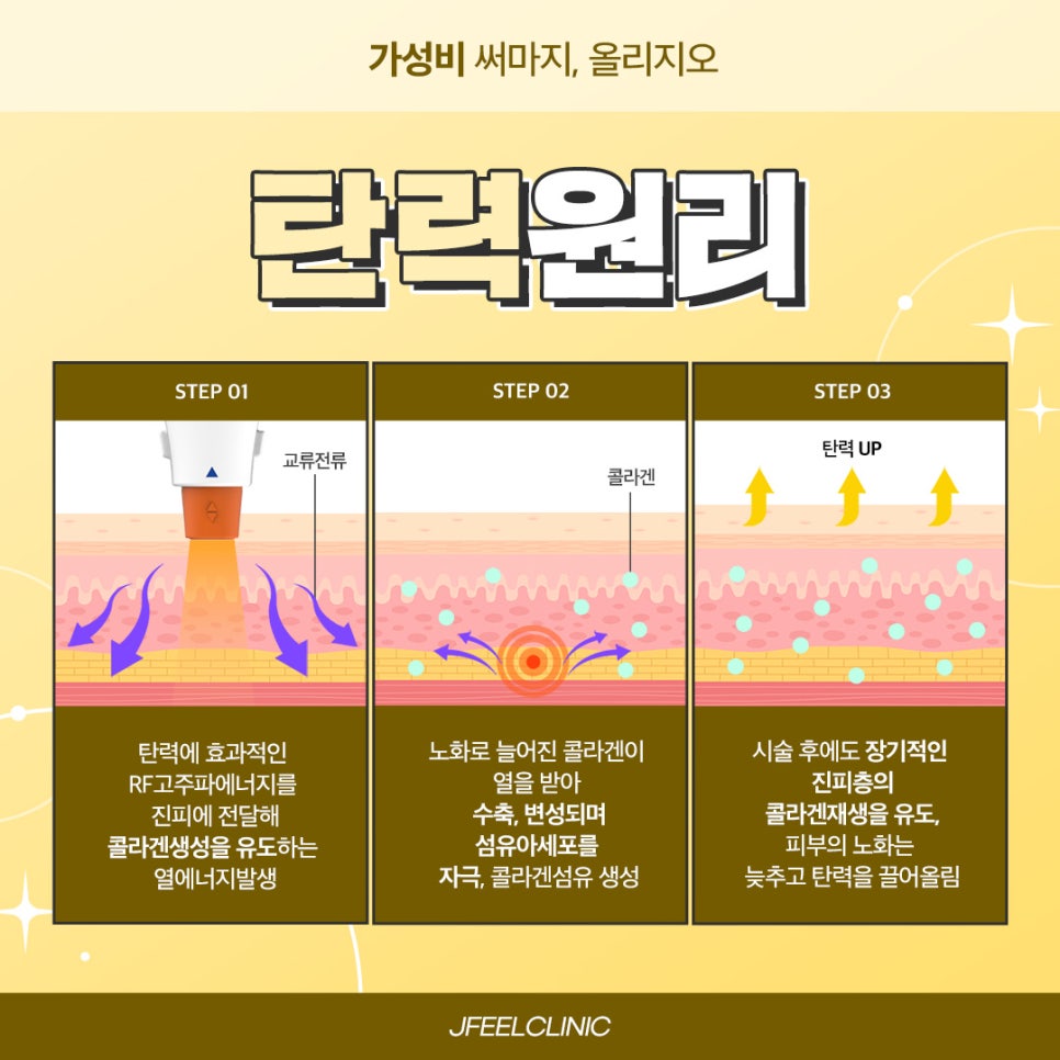 올리지오통증과 소요 시간, 효과 지속 기간 등 Q&A 관련 이미지 4