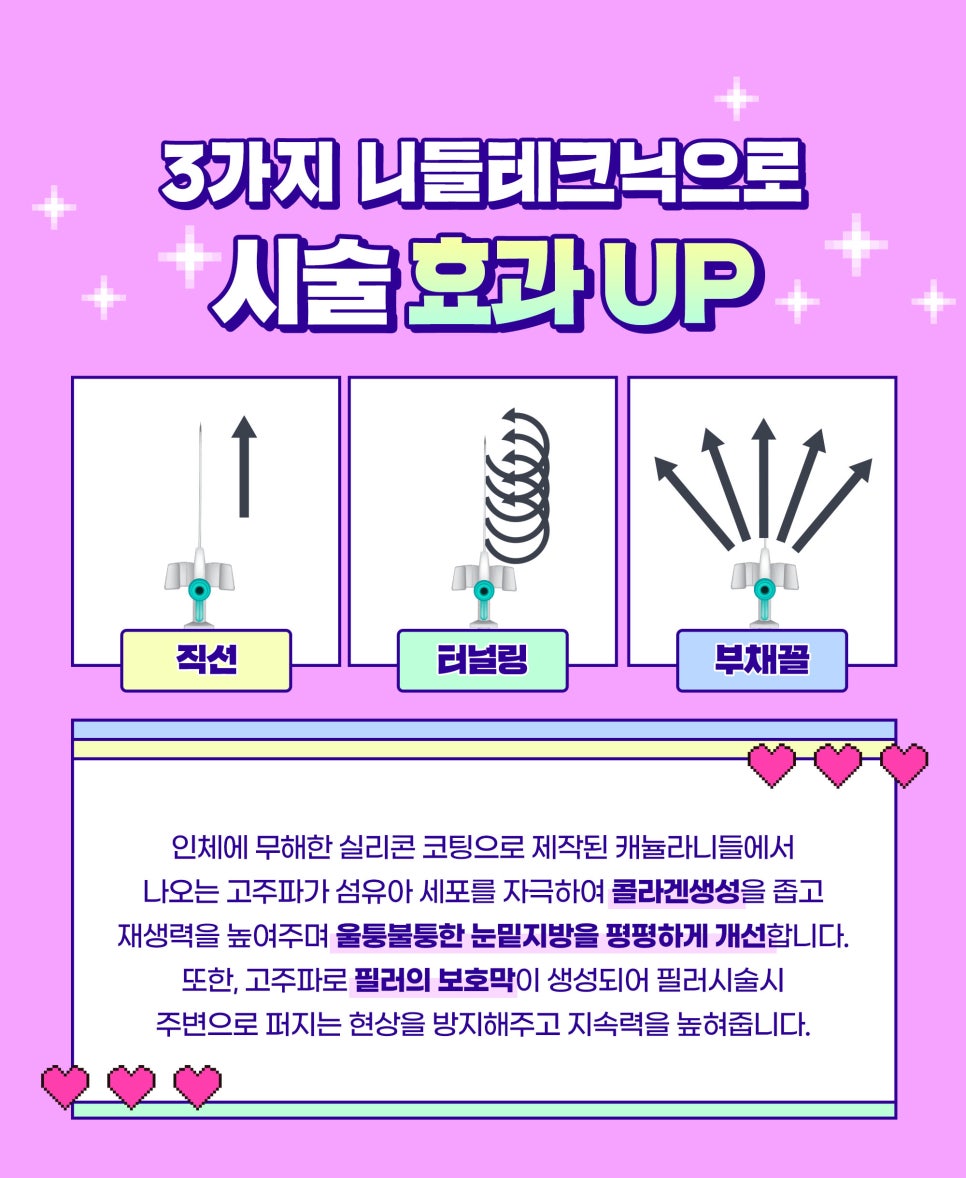 수술없이 눈밑지방재배치 레이저! 가격,효과,후기까지 관련 이미지 3