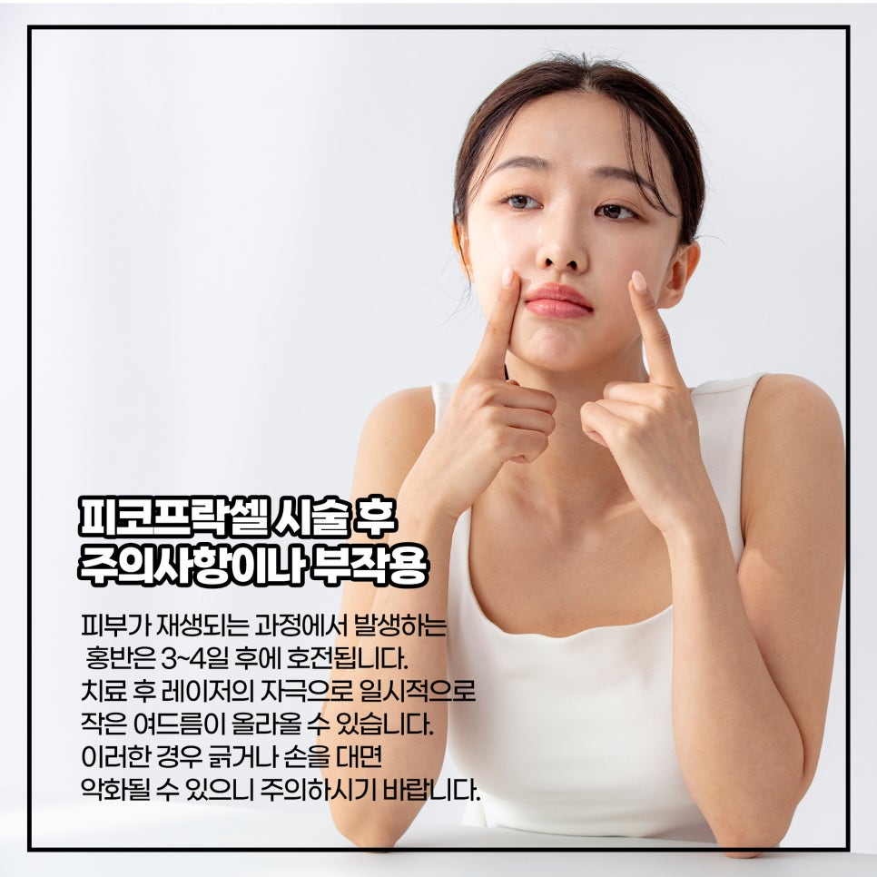모공축소, 여드름흉터 치료 시술 Q&A 관련 이미지 2