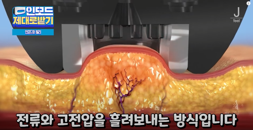 인모드효과 못 보셨다면 여기로 관련 이미지 7